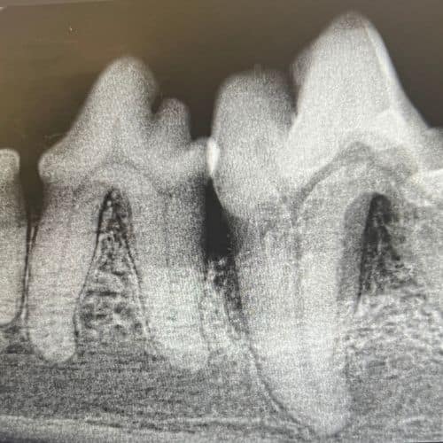 A close-up of a tooth